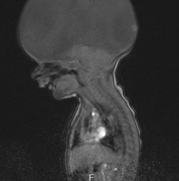 Không thể tin nổi người sinh ra không não vẫn sống khỏe mạnh, IQ cao vượt người thường - 3