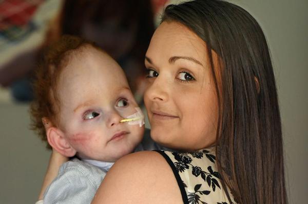 Không thể tin nổi người sinh ra không não vẫn sống khỏe mạnh, IQ cao vượt người thường - 4