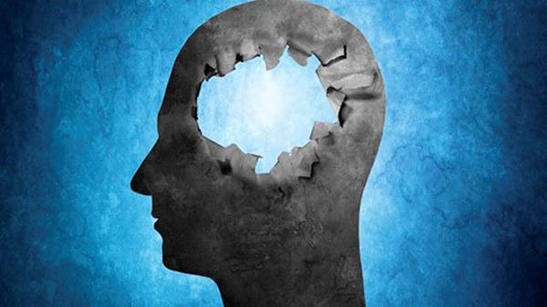 Không thể tin nổi người sinh ra không não vẫn sống khỏe mạnh, IQ cao vượt người thường - 1