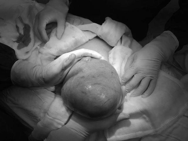Đột nhiên đi tiểu nhiều, U50 ngỡ ngàng khi biết mắc căn bệnh phụ nữ đáng sợ