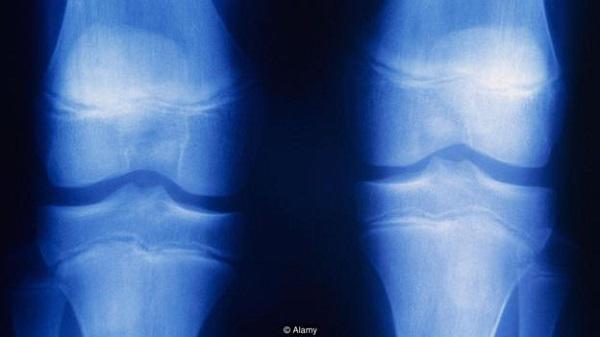 khong gian ki la ron nguoi trong can phong "yen tinh nhat the gioi", nghe duoc ca... tieng xuong khop - 2