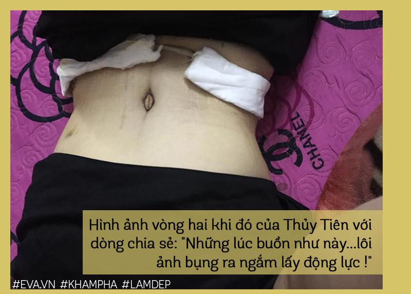 Để lột xác như Đức Phúc, amp;#34;Hot girl trăm kýamp;#34; Thuỷ Tiên lên bàn mổ cắt 8 lít mỡ! - 4