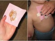 Nuôi con - Bà mẹ tự chữa khỏi ho cho con chỉ sau 4 giờ bằng miếng dán mật ong