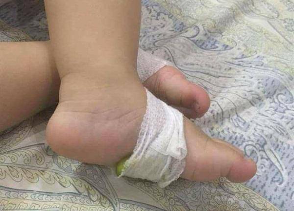 Hạ sốt cho trẻ bằng lươn sống, buộc chanh vào chân: Mẹ bỉm sữa tin dùng, bác sĩ nói amp;#34;Đừng!amp;#34; - 6