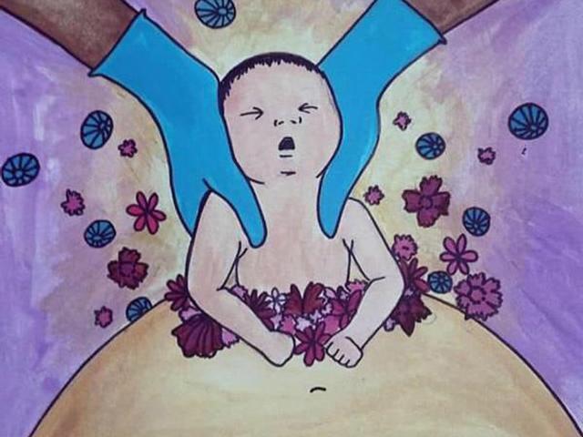 Bộ ảnh vinh danh những bà mẹ đẻ mổ lay động trái tim người xem