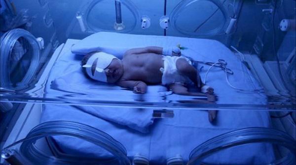 Đừng xem nhẹ nguy hiểm từ nụ hôn, nhiều bé sơ sinh đã gặp nạn, thậm chí là tử vong - 3