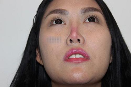 Khuôn mặt cứng đơ, năm lần bảy lượt biến dạng khiến mỹ nhân Việt vướng nghi vấn PTTM - 8