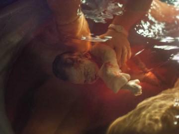 Ca sinh êm ái của bà mẹ vừa đẻ con vừa ngắm hoàng hôn ngay trong vườn nhà