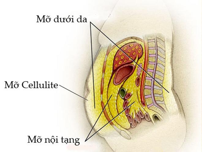 Cận cảnh một ca hút mỡ bụng khiến người phụ nữ cứng rắn nhất cũng phải… bật khóc! - 1