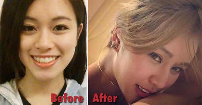 Chiều lòng bạn trai, mỹ nhân Hồng Kông trải qua 30 cuộc phẫu thuật thẩm mỹ đầy đau đớn! - 8