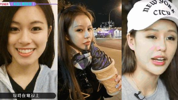 Chiều lòng bạn trai, mỹ nhân Hồng Kông trải qua 30 cuộc phẫu thuật thẩm mỹ đầy đau đớn! - 9