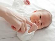 Nuôi con - 13 vấn đề về da thường gặp ở trẻ sơ sinh làm mẹ phải biết rõ