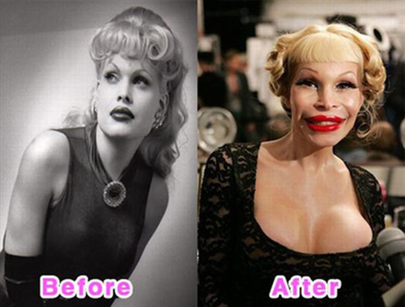 Môi khi nhắc đến đôi môi "dị" không thể quên tên Amanda Lepore. 
