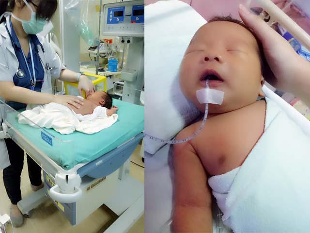 Bé sơ sinh nhập viện khẩn cấp vì mẹ cho uống nước nho để trị vàng da