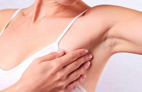 Phụ nữ châu Á mắc hai sai lầm cực kỳ lớn khiến bệnh ung thư vú trở nên nghiêm trọng - 3