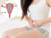 Sức khỏe - Nguyên nhân ít ai ngờ của bệnh ung thư nhau thai nguy hiểm mà không nhiều người hiểu rõ