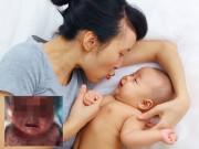 Nuôi con - Bé sơ sinh 3 tháng tuổi lở loét khắp người vì được mẹ... hôn mỗi ngày