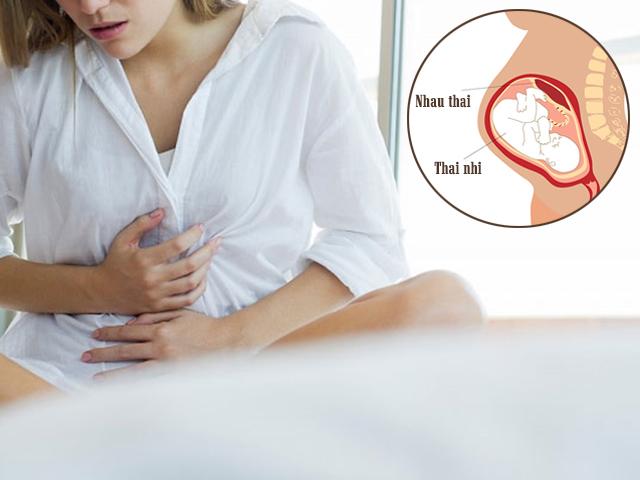 Ngoài ung thư nhau thai, còn có 5 bất thường về nhau thai mà phụ nữ nào cũng phải biết