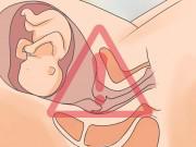 Bà bầu - Rỉ ối bao lâu thì sinh?