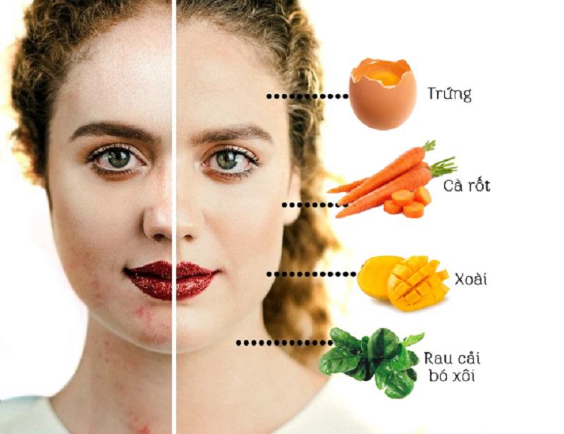 Nếu có làn da dầu, bạn nên ăn nhiều thực phẩm giàu vitamin A.
