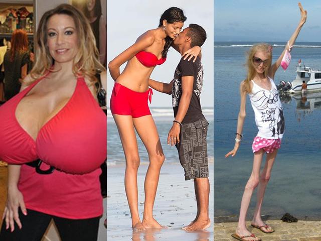 Những người phụ nữ kỳ lạ nhất hành tinh (P1): Từ bộ ngực 14kg đến vòng eo 38cm