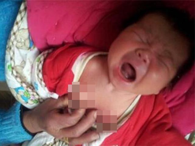 Ham làm đẹp cho con đến mấy cũng đừng đụng đến 4 mẹo dân gian phi khoa học này!