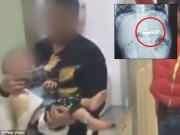 Làm mẹ - Bé 16 tháng nuốt gọn chiếc bấm móng tay vào bụng vì nghĩ rằng mẹ đùa với mình