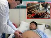 Yêu con - Ăn thịt nướng mỗi ngày, cậu bé bị vàng da, mắc bệnh ung thư tuyến tụy