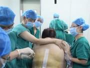 Bà bầu - Bác sĩ "mướt mồ hôi" cắt qua 15cm mỡ của mẹ bầu nặng 135kg để cứu thai nhi