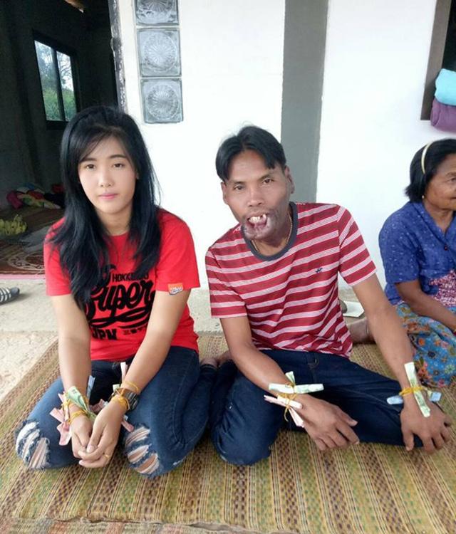 Bất chấp xã hội gièm pha về ngoại hình, cặp đôi amp;#34;đũa lệchamp;#34; vẫn sống vô cùng hạnh phúc - 1