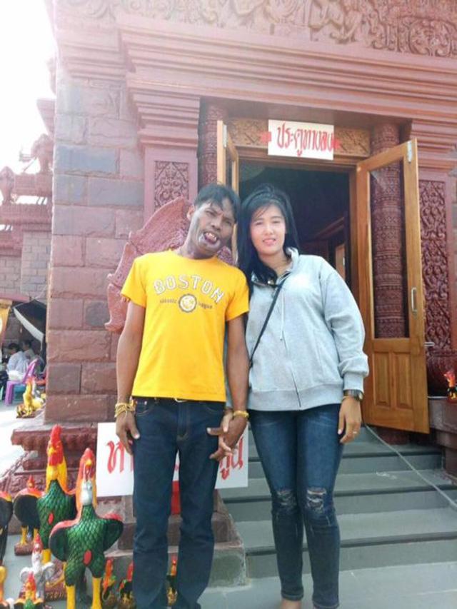 Bất chấp xã hội gièm pha về ngoại hình, cặp đôi amp;#34;đũa lệchamp;#34; vẫn sống vô cùng hạnh phúc - 3