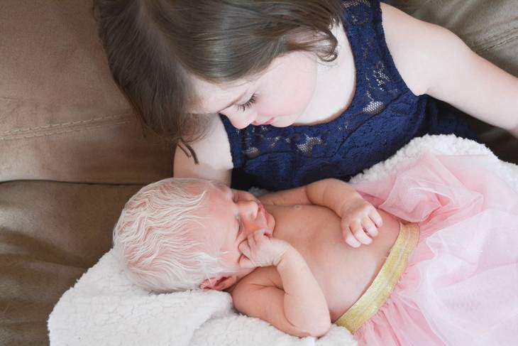 Câu chuyện cảm động về bé sơ sinh có mái tóc bạc trắng nhưng xinh như nàng công chúa - 5