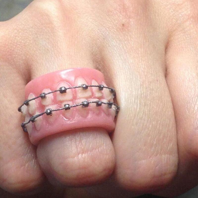 Những người đeo chiếc nhẫn này chắc hẳn là người yêu của anh...bác sĩ nha khoa.
