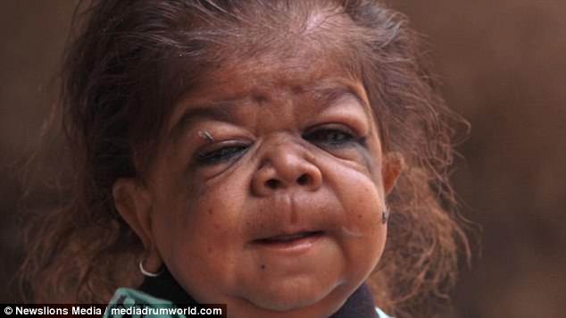 Sự thật về amp;#34;đứa trẻ 1 tuổiamp;#34; hay cười nhưng không thể nói và mãi không bao giờ lớn - 5