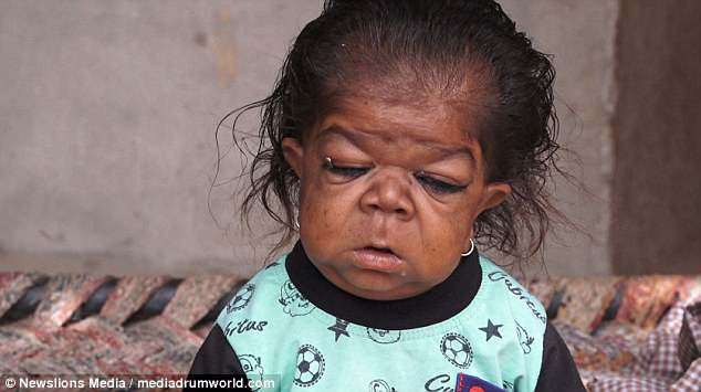 Sự thật về amp;#34;đứa trẻ 1 tuổiamp;#34; hay cười nhưng không thể nói và mãi không bao giờ lớn - 6