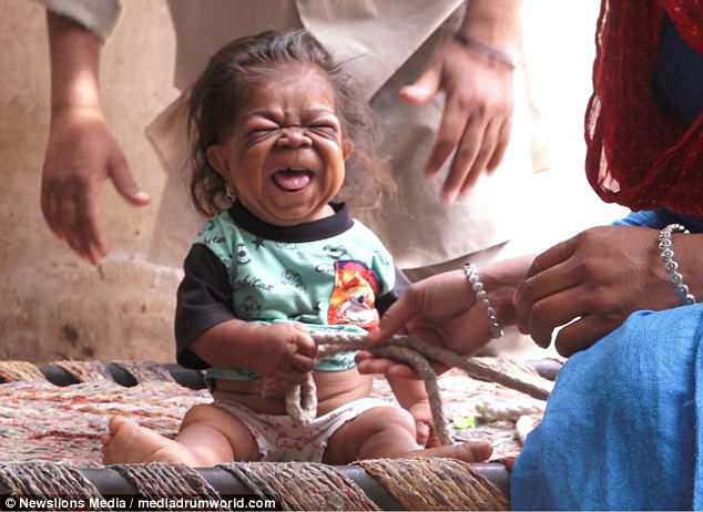 Sự thật về amp;#34;đứa trẻ 1 tuổiamp;#34; hay cười nhưng không thể nói và mãi không bao giờ lớn - 1