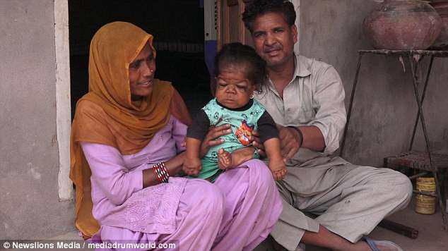 Sự thật về amp;#34;đứa trẻ 1 tuổiamp;#34; hay cười nhưng không thể nói và mãi không bao giờ lớn - 4