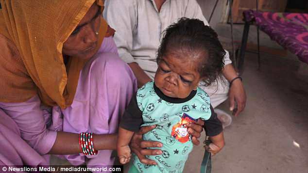 Sự thật về amp;#34;đứa trẻ 1 tuổiamp;#34; hay cười nhưng không thể nói và mãi không bao giờ lớn - 7