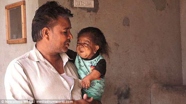 Sự thật về amp;#34;đứa trẻ 1 tuổiamp;#34; hay cười nhưng không thể nói và mãi không bao giờ lớn - 3