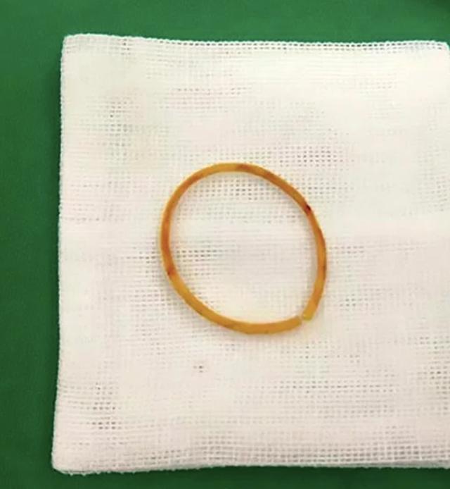 Bé gái 4 tuổi suýt mất một bên tay chỉ vì vật dụng nhỏ xíu nhà nào cũng có - 4