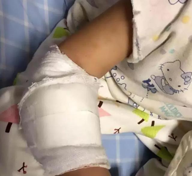 Bé gái 4 tuổi suýt mất một bên tay chỉ vì vật dụng nhỏ xíu nhà nào cũng có - 5