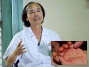 Làm mẹ - Bệnh tay chân miệng ở trẻ em: 6 việc mẹ cần làm tại nhà để bé nhanh khỏi