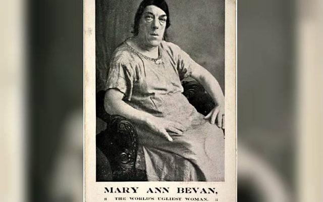 Những người phụ nữ kỳ lạ nhất (P1): Từ khuôn mặt đàn ông đến amp;#34;người vượnamp;#34; đi diễn xiếc - 1