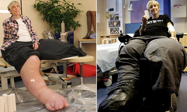 Những người phụ nữ kỳ lạ nhất (P1): Từ khuôn mặt đàn ông đến amp;#34;người vượnamp;#34; đi diễn xiếc - 3