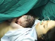 Bà bầu - Bác sĩ Bệnh viện Phụ sản TW: "Sinh mổ có nhiều nguy cơ cho cả mẹ và bé"