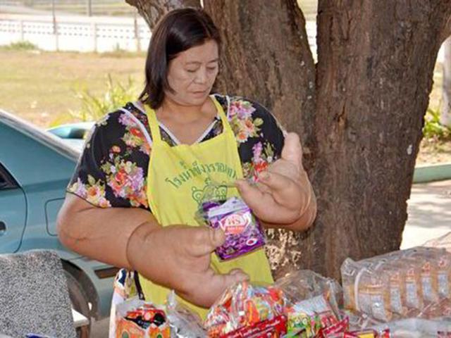 Người phụ nữ có đôi tay khủng nhất hành tinh, bác sĩ lắc đầu nói vô phương cứu chữa