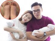 Giải trí - Sinh đôi con gái cho đại gia, chân dài Hong Kong lộ đôi chân sưng phù đáng sợ