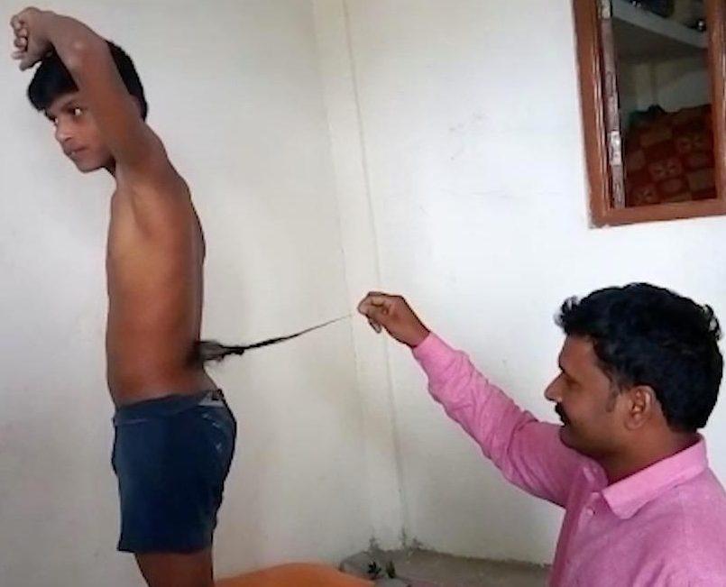 Cậu bé mắc dị tật bẩm sinh có đuôi dài gần nửa mét được tôn như amp;#34;thánhamp;#34; - 1