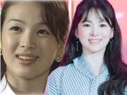 Đẹp - Không riêng gì Song Hye Kyo, nhiều Sao cũng thành mỹ nhân nhờ chỉnh răng!