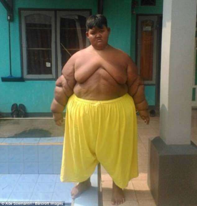 Bé trai 10 tuổi nặng 190kg vì ăn 5 bữa mỗi ngày với gà rán, cơm, mì và kem - 4